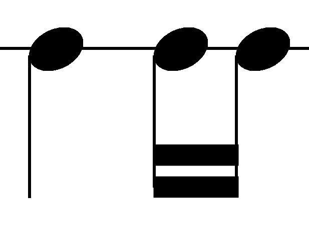 Opción B